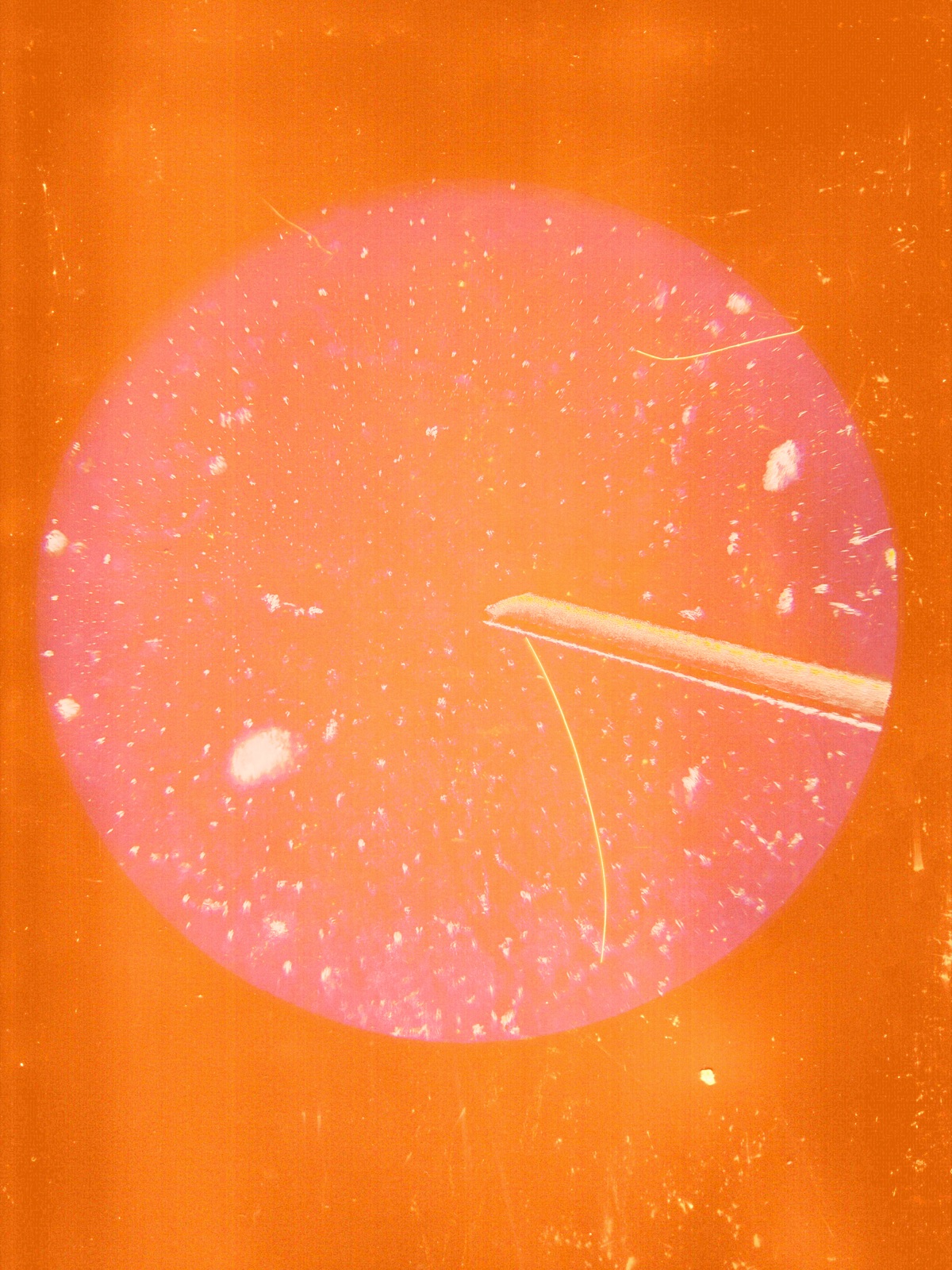 Somatic Nebula No.2